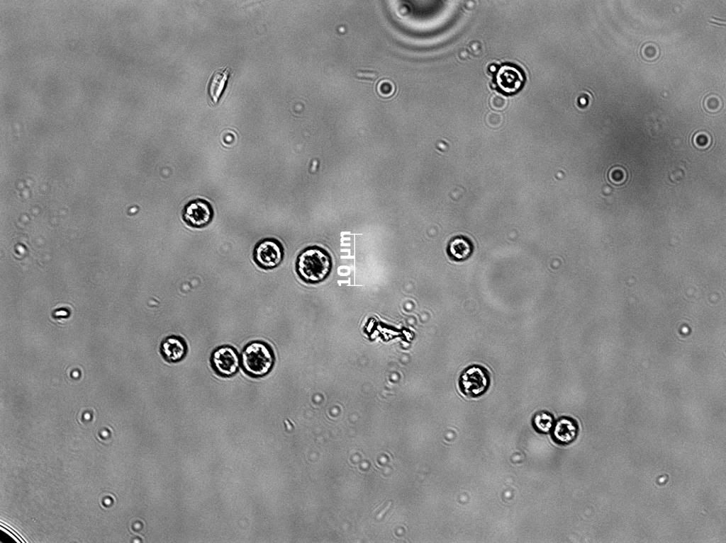 Nannochloropsus001 zpsf444bf07 - Phytoplankton Microscopy