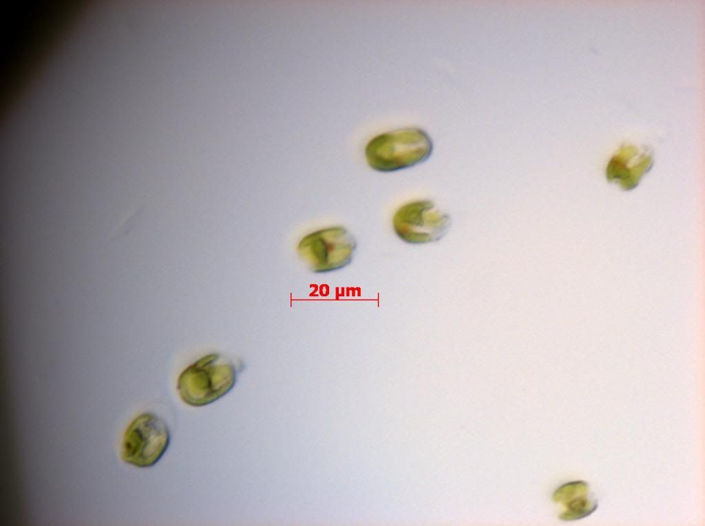 SNAP 181343 0016 zps55c21b27 - Phytoplankton Microscopy NOW IN COLOR!!!