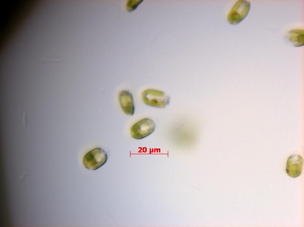 SNAP 181445 0018 zpsb6a55e50 - Phytoplankton Microscopy NOW IN COLOR!!!