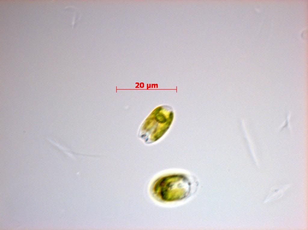 SNAP 181953 0020 zpsdd3cb5b3 - Phytoplankton Microscopy NOW IN COLOR!!!