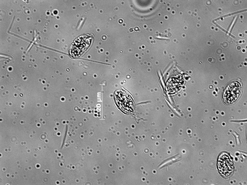 Tetraselmis001 zpse84de151 - Phytoplankton Microscopy