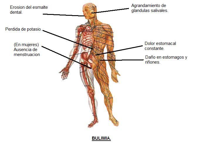 Bulimia (c) Fndr159 bulimia nervosa help